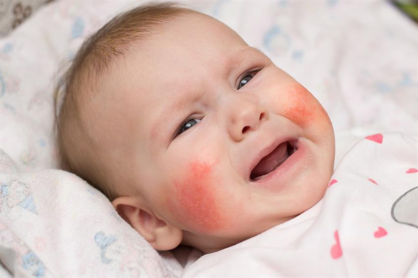 Weinendes Baby mit roten Wangen