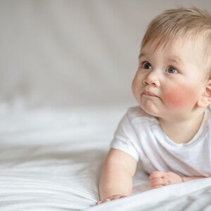 Allergieprävention – Mikrobiom, Ernährung, Allergenkontakt als wichtige Einflussgrößen Nicht gelistet