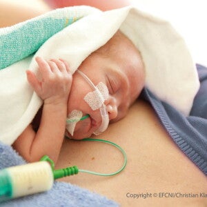 EFCNI Workshops (news)